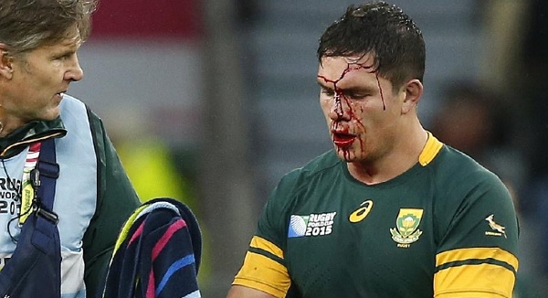 South Africa rugby injury blood